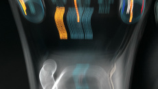 Ford Puma 1.0 EcoBoost Hybrid mHEV ST-Line X 5dr Petrol Hatchback